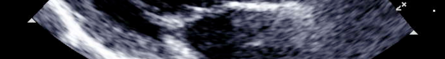 2026 EDW Echo Education Conference (RSS) Banner